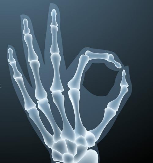 Строение кисти левой руки. Анатомия кисти. Строение костей кисти.
