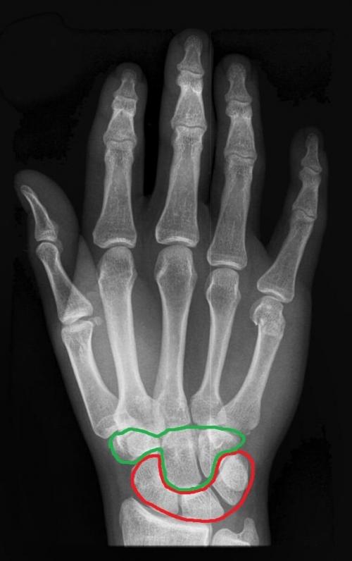 Строение кисти левой руки. Анатомия кисти. Строение костей кисти.