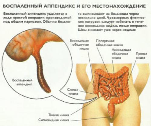 Температура боль в животе. Какие заболевания сопровождаются болью в животе, поносом и температурой
