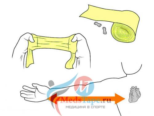 Как правильно забинтовать плечо эластичным бинтом при растяжении. Часть 1: Перевязка поврежденного запястья