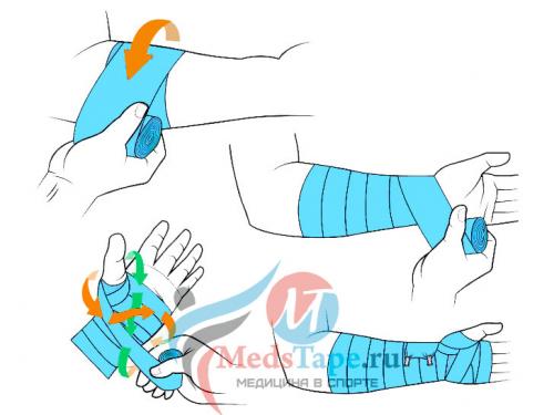 Как правильно забинтовать плечо эластичным бинтом при растяжении. Часть 1: Перевязка поврежденного запястья