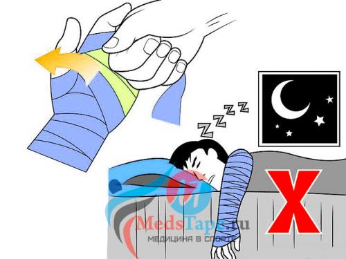 Как правильно забинтовать плечо эластичным бинтом при растяжении. Часть 1: Перевязка поврежденного запястья