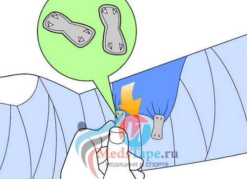 Как правильно забинтовать плечо эластичным бинтом при растяжении. Часть 1: Перевязка поврежденного запястья