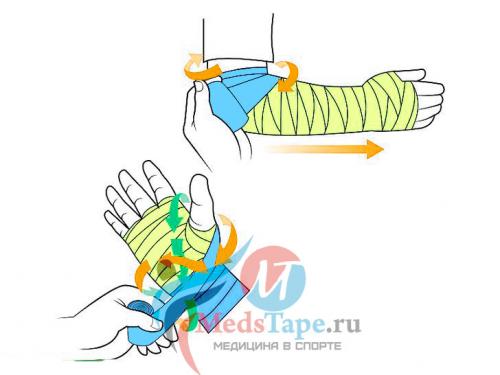 Как правильно забинтовать плечо эластичным бинтом при растяжении. Часть 1: Перевязка поврежденного запястья