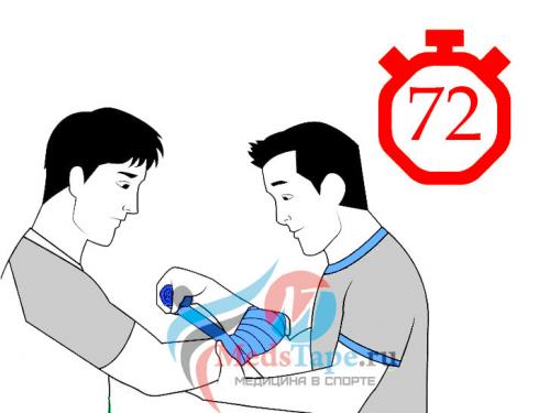 Как правильно забинтовать плечо эластичным бинтом при растяжении. Часть 1: Перевязка поврежденного запястья