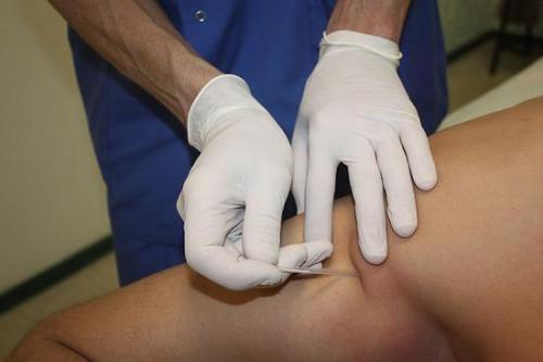 Хруст в плечевом суставе и боль. От чего появляется? 08