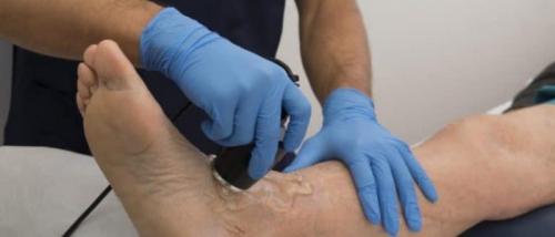 Узи голеностопного сустава. Ультразвуковое исследование голеностопного сустава