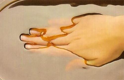 Польза парафинотерапии для суставов. Парафин для лечения суставов: полезные свойства и применение