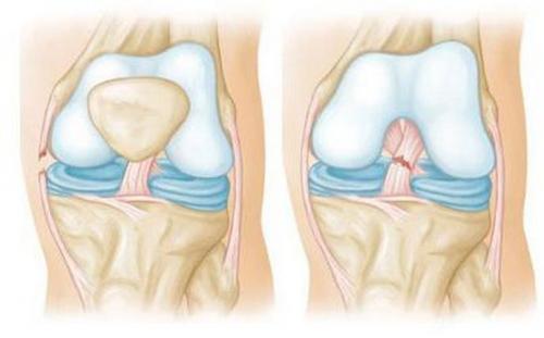 Спортивный желатин. Показания и противопоказания к применению