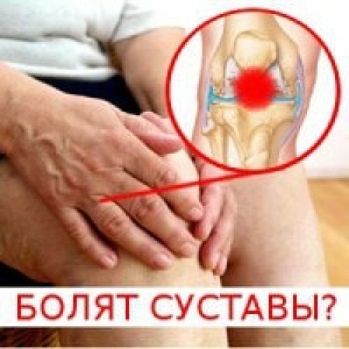 Цилиндрические суставы примеры. Классификация суставов 03