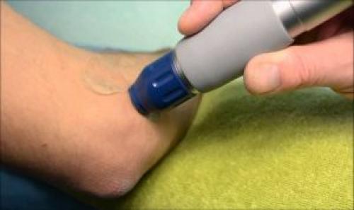 Вывих локтевого сустава. Вывих сустава локтя