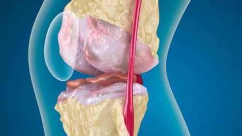 Хондропротекторы для суставов в беларуси. Хондропротекторы для суставов: список лучших препаратов, отзывы 01