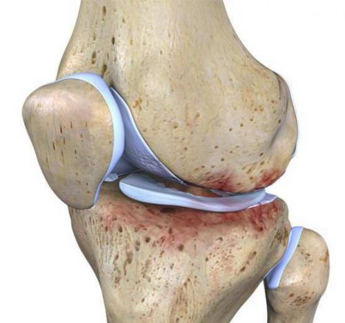 Болит колено сбоку с внешней стороны лечение. Как может болеть колено?