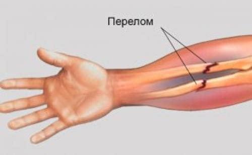 Парафинотерапия голеностопного сустава. Парафин для прогревания суставов