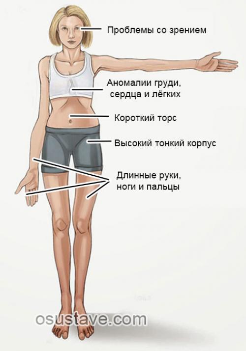 Разрыв заднего рога и тела медиального мениска правого коленного сустава. Причины и механизмы разрыва мениска
