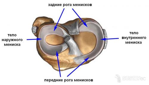 Разрыв заднего рога медиального мениска коленного сустава лечение 3 степени. Почему происходит травмирование