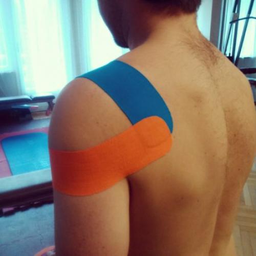 Тейпирование плеча при бурсите. Показания к применению и основные техники