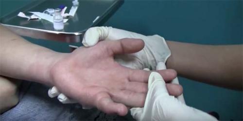 Опухли суставы пальцев рук лечение. Основные причины и методы лечения опухших суставов пальцев на руке