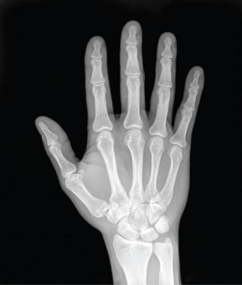 Строение пальцев руки человека. Кости руки 03 Строение пальцев руки человека. Кости руки 03