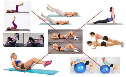 Диета при диастазе живота. Упражнения для пресса при диастазе