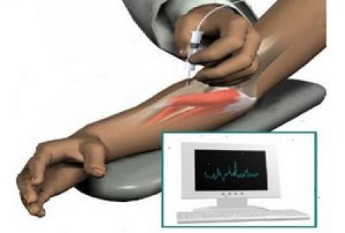 Что такое мышечное истощение. Атрофия мышц