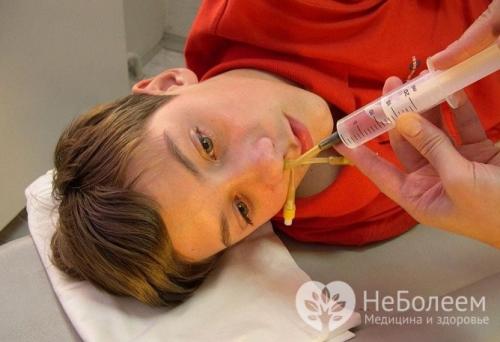 Лечение аденоидов без операции. Как вылечить аденоиды без операции у детей