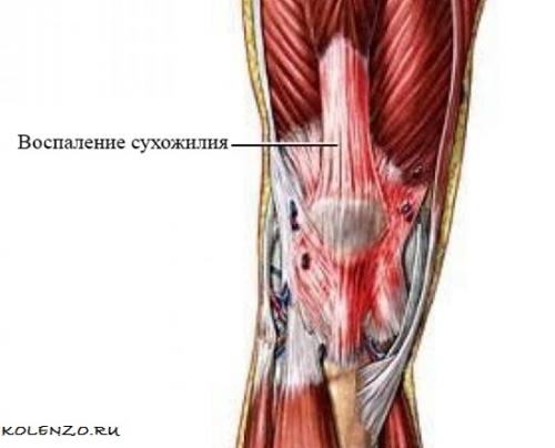 При боли в колене, что лучше помогает. Эффективные средства от боли в коленном суставе