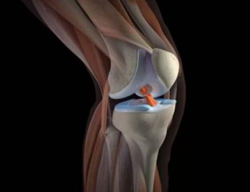 Как лечить боль в колене быстро в домашних условиях. Строение коленного сустава