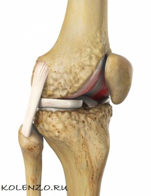 При боли в колене, что лучше помогает. Эффективные средства от боли в коленном суставе