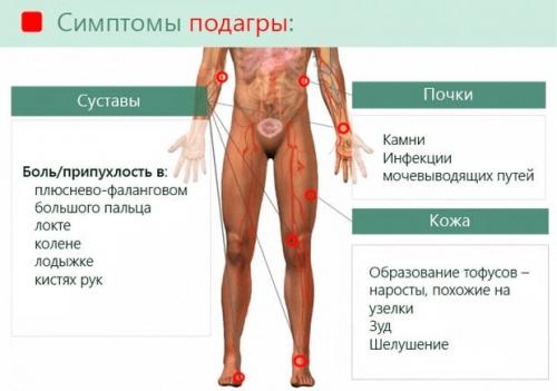 Шишка на пальце руки под кожей болит. Симптомы
