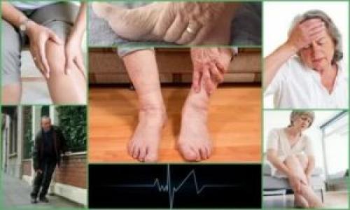 Слабость в ногах лечение народными средствами. Старческая немощь лечение народными средствами. Мышечная слабость у пожилых людей. Мышечная слабость – слабость в ногах, как симптом – Лечение