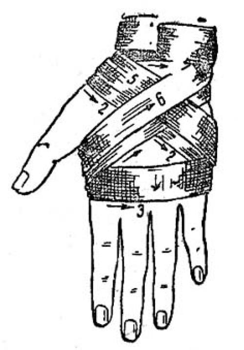 Черепашья повязка сходящаяся. Черепашья повязка на локтевой и коленный сустав (сходящаяся и расходящаяся) 08