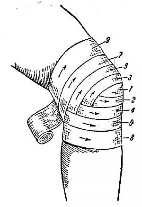 Повязка на локоть схема