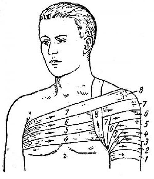 Черепашья повязка сходящаяся. Черепашья повязка на локтевой и коленный сустав (сходящаяся и расходящаяся) 09