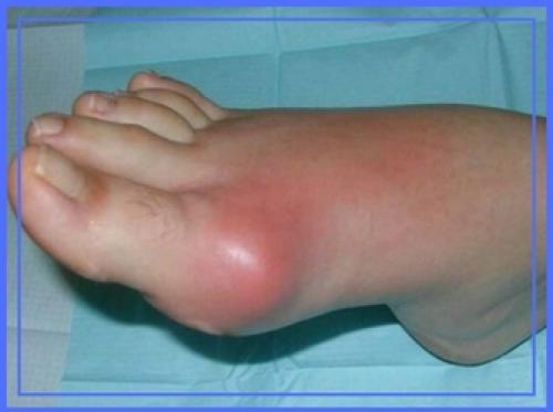 Если растут косточки на ногах к какому врачу обращаться. К какому врачу идти