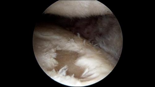 Как лечить суставы колен. Народные методы лечения боли в коленных суставах: как не навредить себе