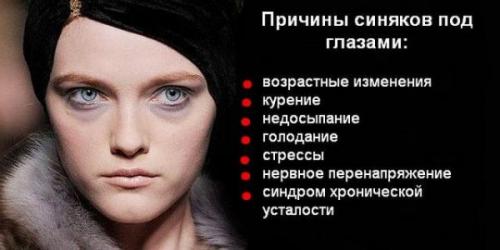Как избавиться от синяков под глазами навсегда. Корректируем образ жизни