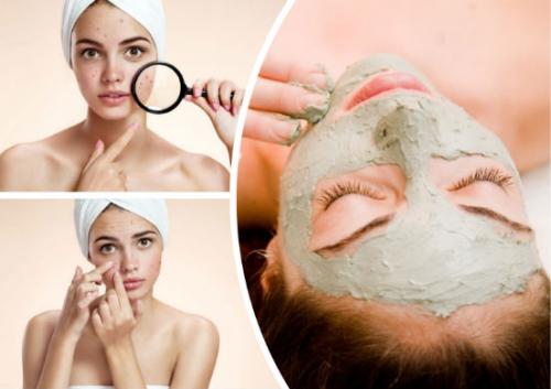 Маски для жирной кожи лица от прыщей в домашних условиях. Маски для жирной кожи — очень действенные рецепты и средства, которые способны избавить вас от прыщей