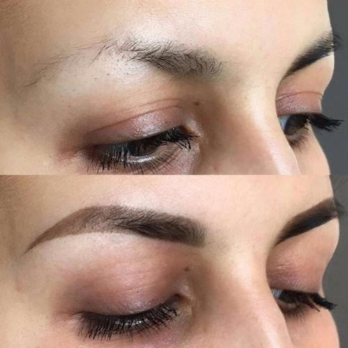 Брови плохо растут. Восстановление бровей