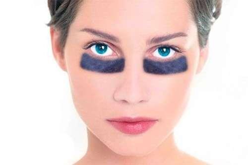 Как избавиться от хронических мешков под глазами. Как быстро избавиться от мешков под глазами