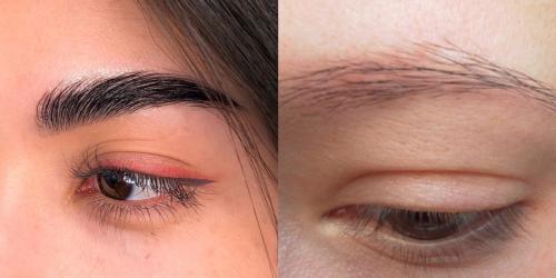 Как отрастить брови в домашних условиях. Почему плохо растут брови? 11