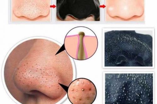 Маски для лица из алоэ от морщин. Биостимулированный сок алоэ от морщин 03