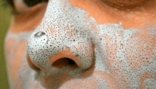 Маски для лица из алоэ от морщин. Биостимулированный сок алоэ от морщин 07