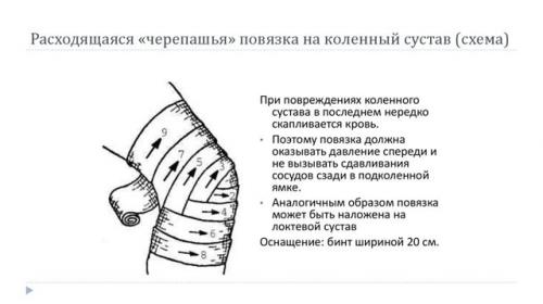 Черепашья повязка на локтевой сустав. Техника наложения повязки черепашья на локтевой сустав