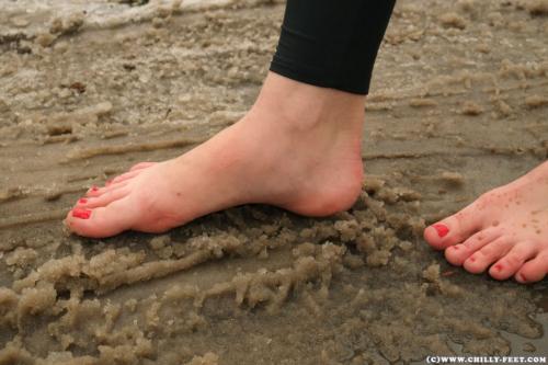 Утолщение суставов на ногах. Косточки на больших пальцах ног — лечение