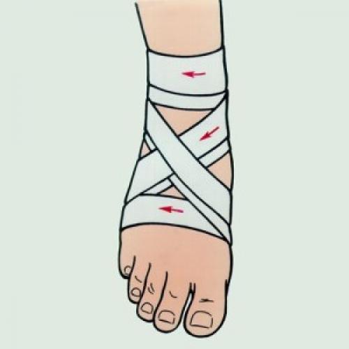 Повязка на голеностопный сустав