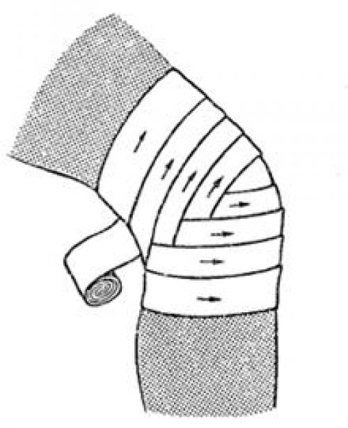 Расходящаяся черепашья повязка на коленный сустав. Черепашья повязка на коленный сустав