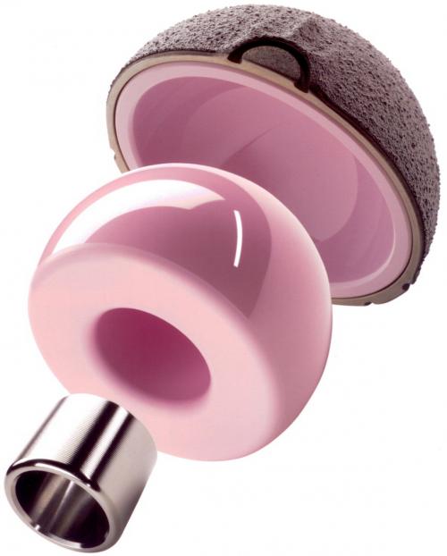 Сколько стоит эндопротез тазобедренного сустава. Купить протез тазобедренного сустава в Москве 01