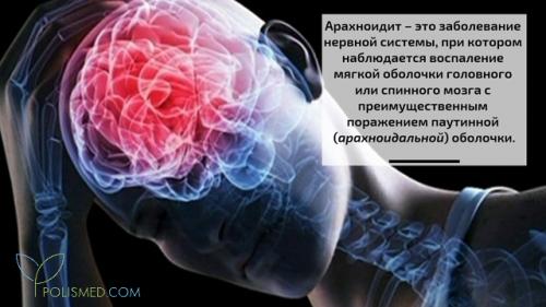 Воспаление сустава мазь. Мазь от воспаления суставов ног 03 Воспаление сустава мазь. Мазь от воспаления суставов ног 03