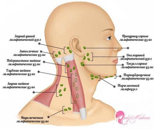 На плече увеличился лимфоузел. Лимфаденопатия (увеличение лимфоузлов)